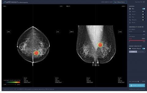 식품의약품안전처 허가를 받은 유방암 진단 보조 소프트웨어 ‘루닛 인사이트 MMG’ 온라인 데모 웹사이트 화면(사진: 루닛)