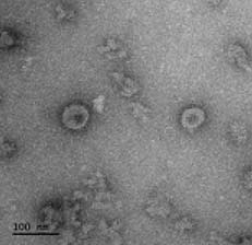 코로나19 바이러스 항원으로 구성된 바이러스유사체 투과전자현미경 이미지.