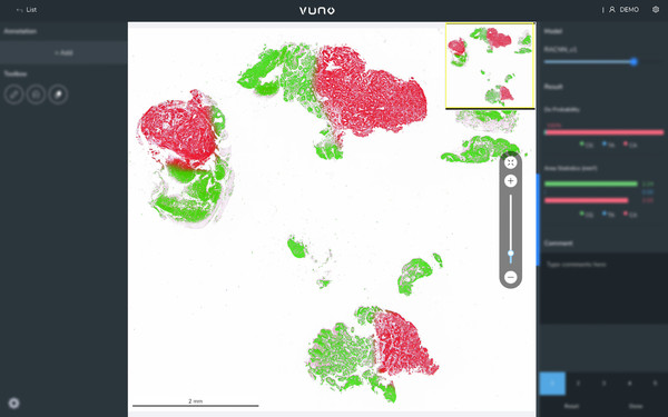 뷰노메드 패스GC AI™ 사용화면