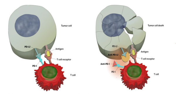 암세포와 T세포 간 연결(왼쪽은 결합해 암세포가 T세포를 교란한 상황, 오른쪽은 면역항암제가 작용해 결합이 이뤄지지 않은 상황.
