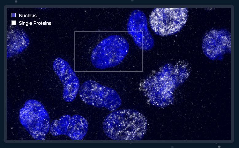세포핵 내 단백질의 이동(Movement of a Protein in the Cell Nucleus). 사진=eikontx.com