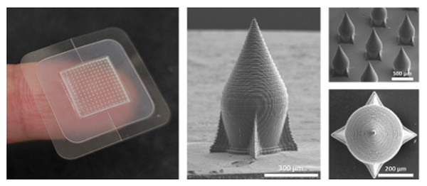 커서스바이오의 마이크로락 패치 사진. MicroLock(마이크로락) 패치(사진 왼쪽), 마이크로락 SEM 이미지.