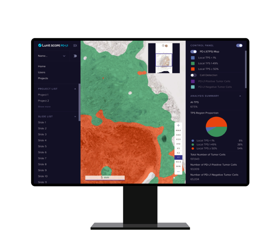 루닛 스코프 PD-L1