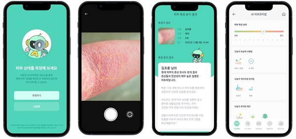 아토맘 제품 이미지 / 사진=아토맘코리아