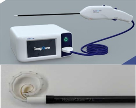 딥큐어가 개발한 혁신 의료기기 하이퍼큐어(HyperQure) / 사진=식약처