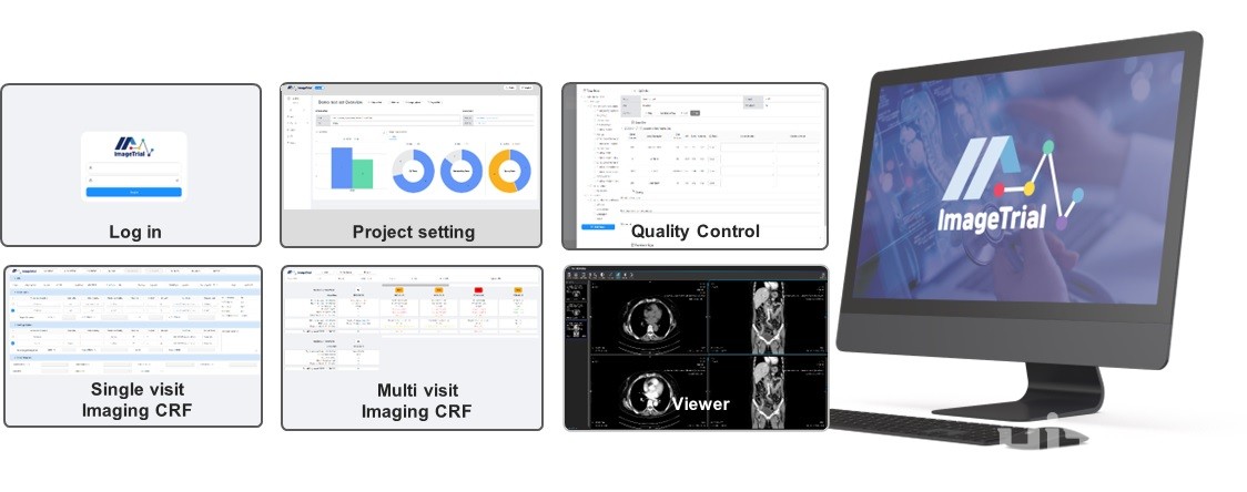 TI 이미지의 영상 품질 관리 서비스