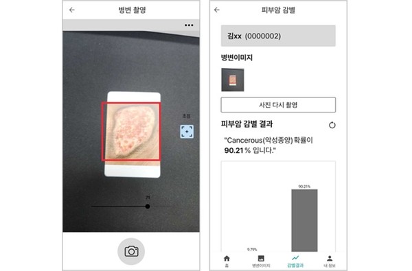 라이프시맨틱스 피부암 진단보조 SW 제품 이미지