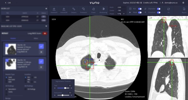 VUNO Med-LungCT AI