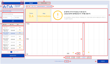 제45호 혁신 의료기기 AiTiAMI / 사진=식품의약품안전처