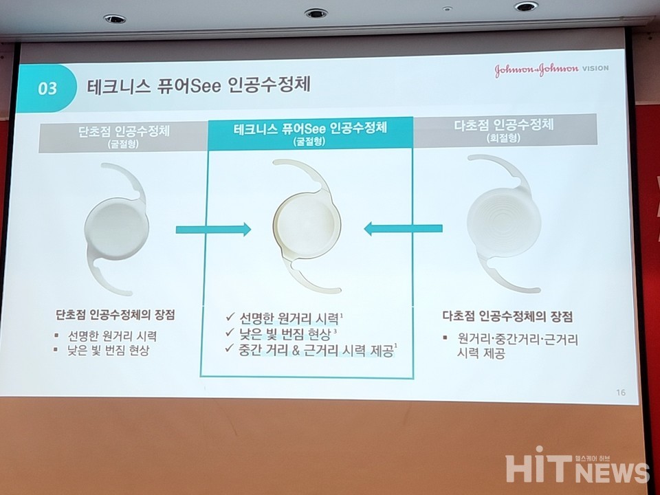 실크라식 수술의 원리와 특징은 무엇인가요?