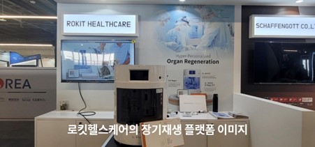 영국 BBC에 소개된 로킷헬스케어의 바이오프린터 '닥터 인비보'의 신장 재생 장면 / 사진= 로킷헬스케어