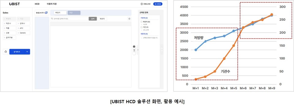유비케어의 UBIST HCD / 사진=유비케어