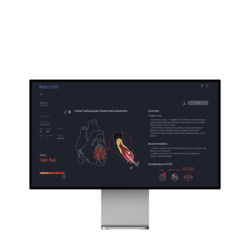 Reti-CVD 모니터 / 사진=메디웨일