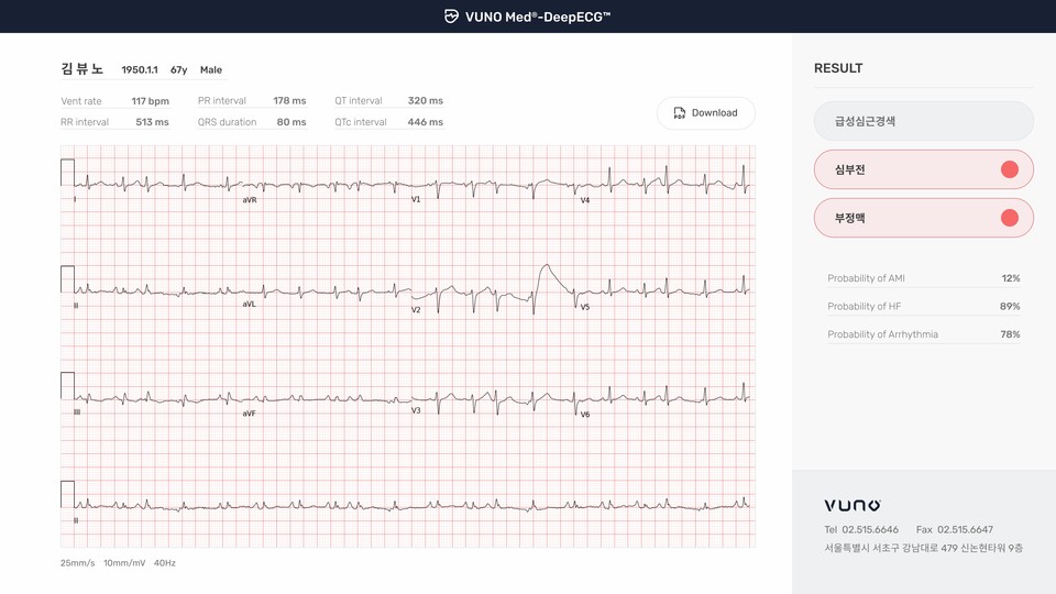 바카라 에볼루션메드 딥ECG 운영 화면 예시 / 사진=바카라 에볼루션