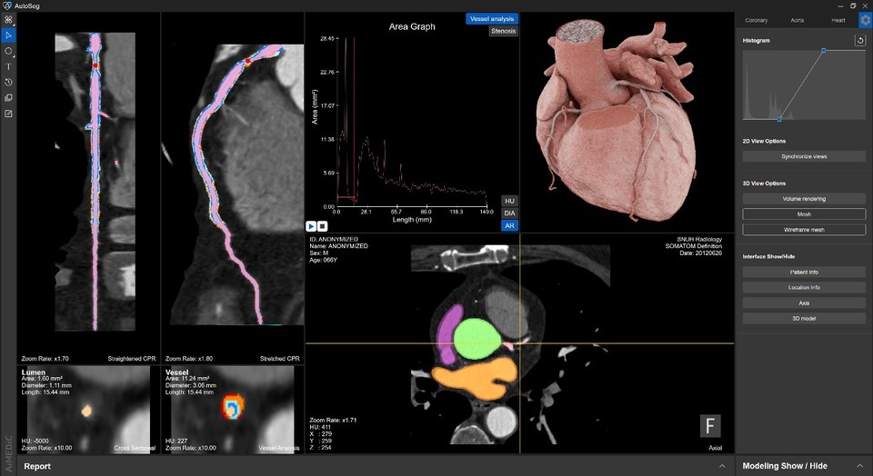 오토세그에이치 측정 결과 사진/사진=에이아이메딕