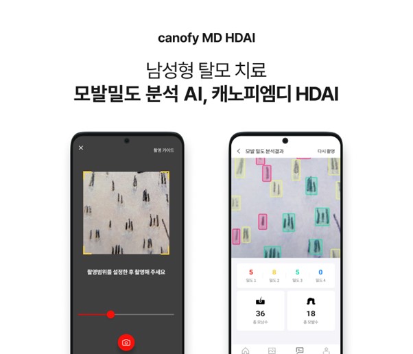 캐노피엠디 HDAI(canofy MD HDAI) 이미지 / 사진=라이프시맨틱스