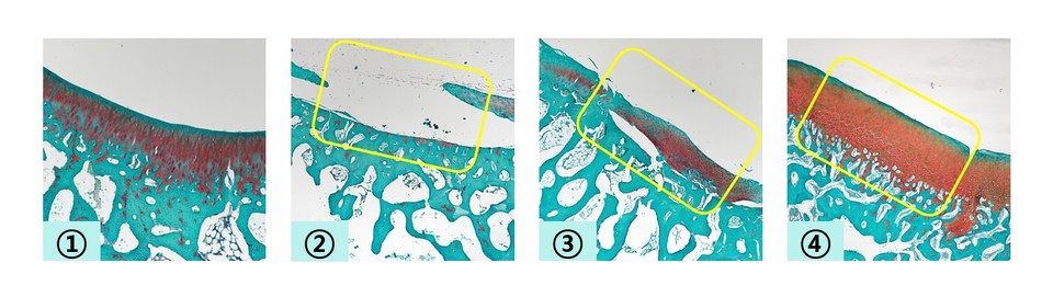 (사진 왼쪽부터) ①정상 대퇴골 ②연골 결손 대퇴골 ③연골 결손 대퇴골에 TGF-β3 미포함 히알루론산 겔을 적용한 후 12주 시점 ④연골 결손 대퇴골에 미세천공술을 적용하고 TGF-β3 포함 히알루론산 겔을 적용한 후 12주 시점의 사진 / 사진=시지토토 꽁머니 지급