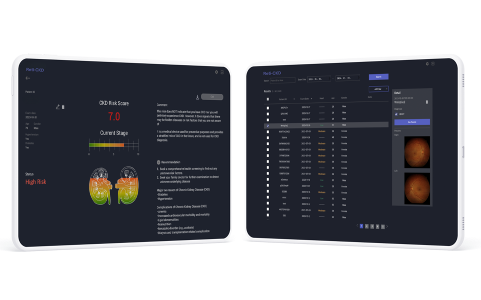 메디웨일이 개발한 망막 이미지 분석 콩팥 토토 바카라 사이트 예측 AI '닥터눈 CKD(Reti-CKD)' / 사진=메디웨일