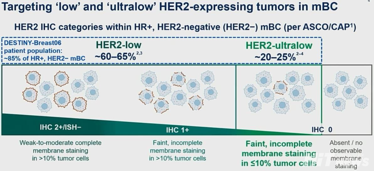 HER2 저발현 및 초저발현 정의 / 사진=ASCO 발표