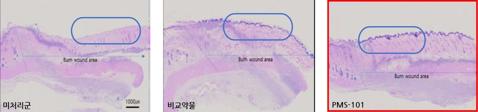 프리모리스테라퓨틱스는 동물실험을 통해 PMS-101 사용 시 새로 성장하는 피부 조직의 길이가 약물 미사용군 대비 45%, 현재 우리 카지노에 적용되는 약물 대비 23% 증가함을 확인했다. / 사진=프리모리스테라퓨틱스