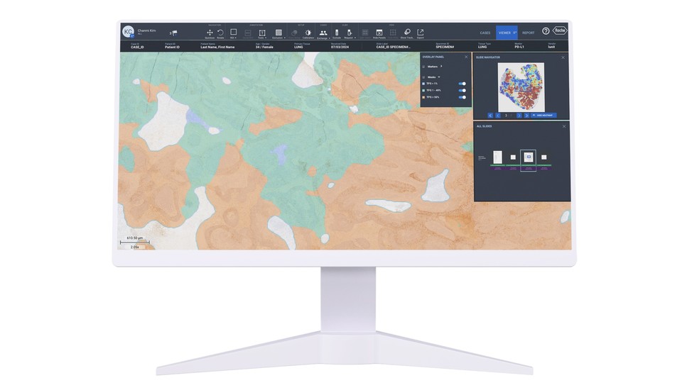 로슈진단 네비파이 디지털 병리 루닛 스코프 PD-L1 / 사진=루닛