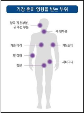사진=대한여드름주사학회