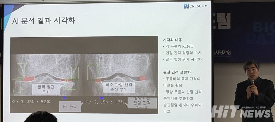 슬롯사이트 2025년과 개발한 무릎슬관절염 판정 모델을 설명하는 신승우 크레스콤 팀장