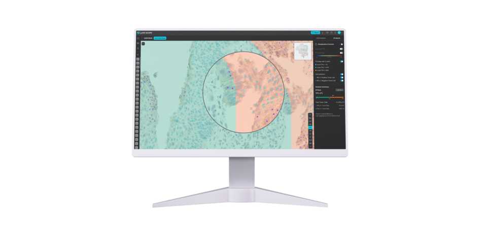 루닛 스코프 uIHC / 사진=루닛