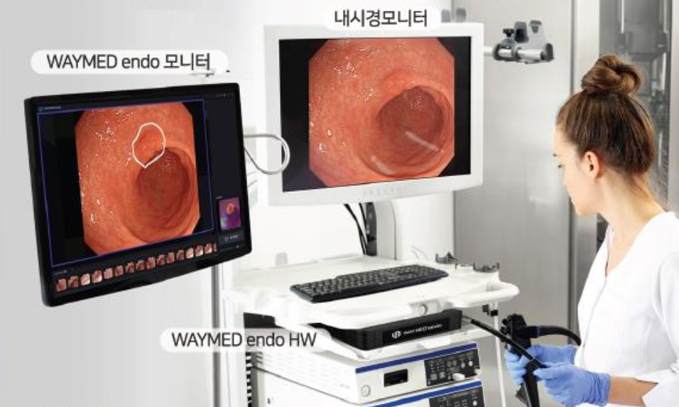 소화기 내시경에 Weymed endo를 설치한 모습 / 사진제공=웨이센