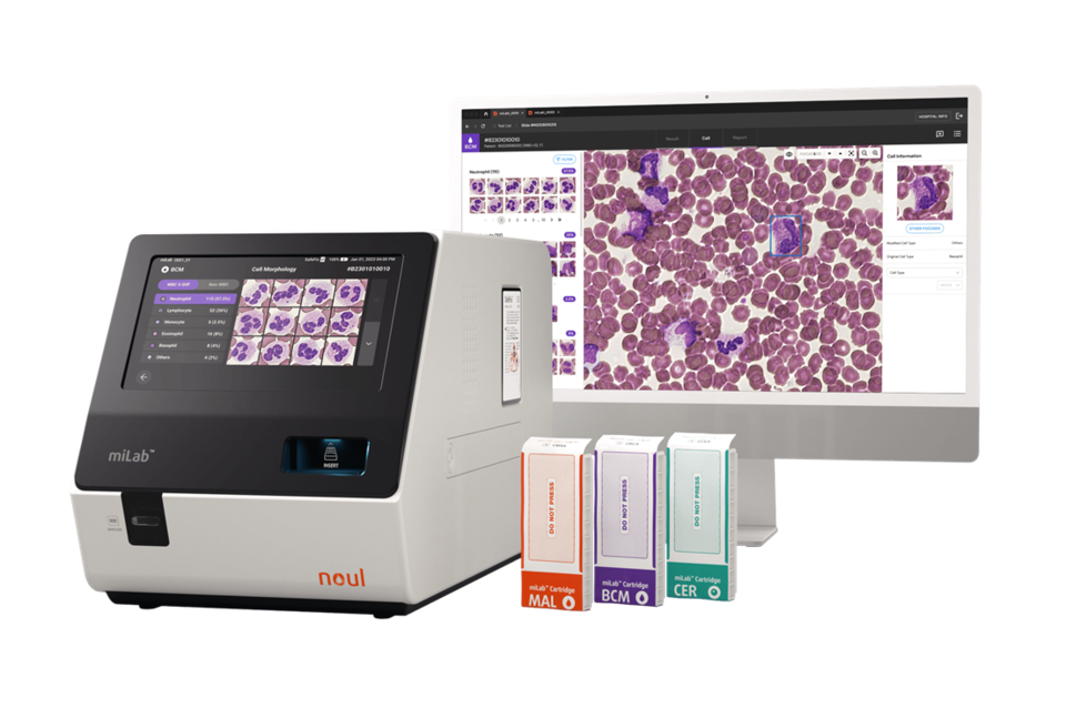 카지노사이트 추천의 혈액 분석 제품 miLab™ BCM / 사진제공=카지노사이트 추천