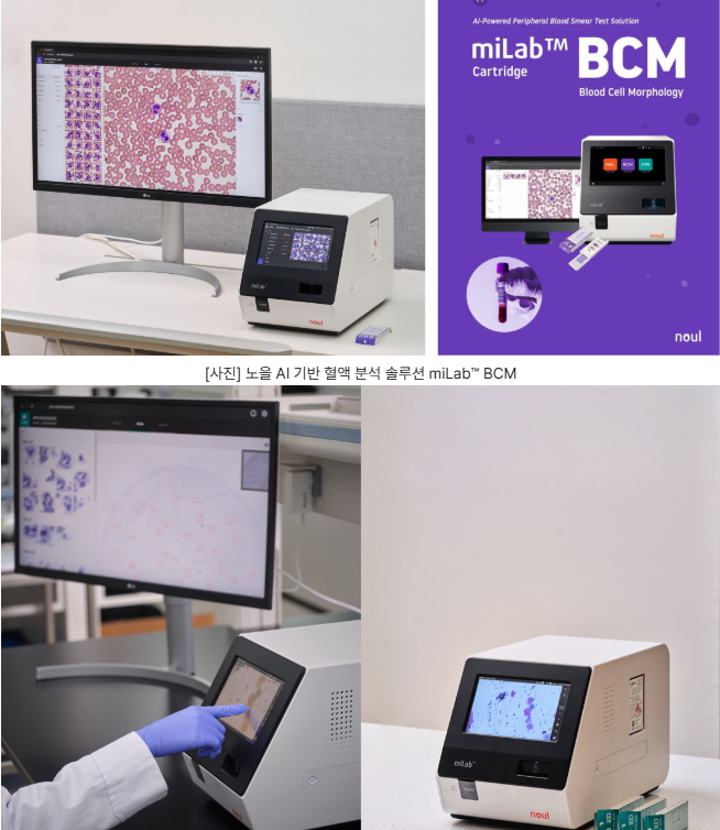 [아래 사진] 노을 자궁경부세포분석 솔루션 miLab™ CER