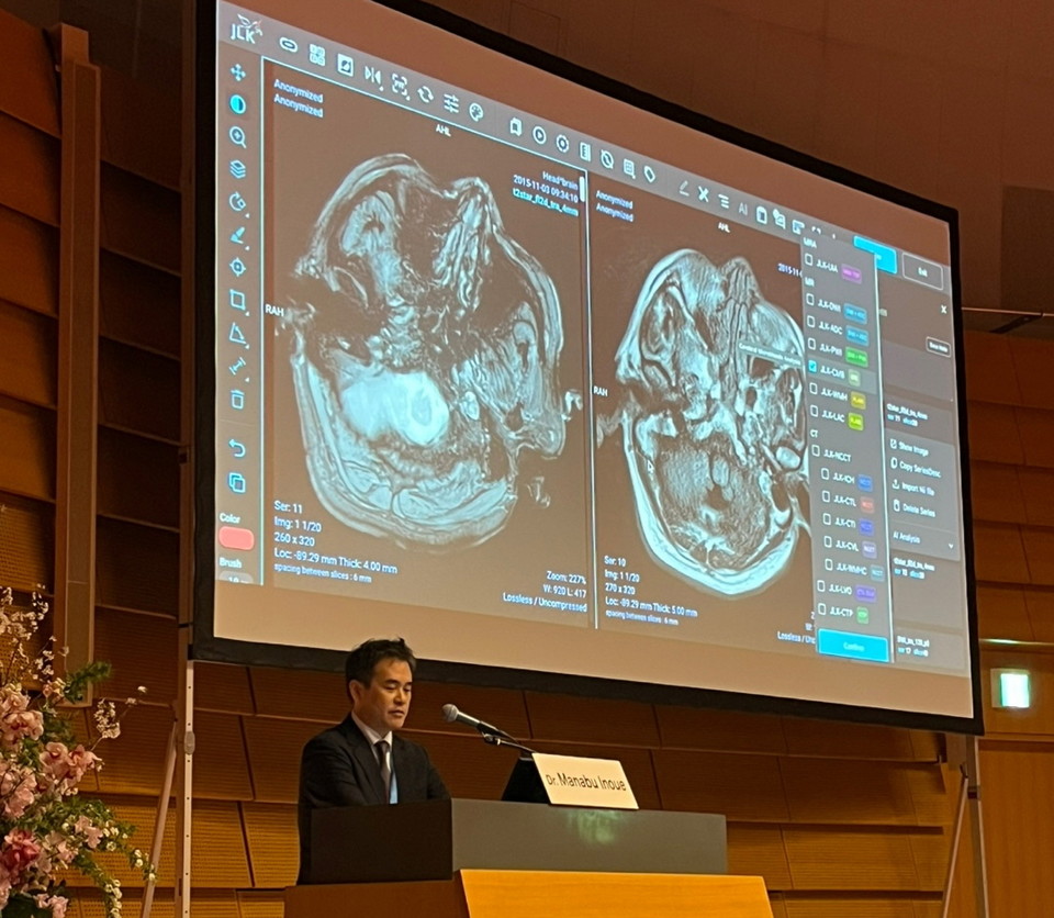 국립뇌심혈관센터 이노우에 마나부 교수가 지난 달 일본 오사카에서 개최된 STROKE 2025 JAPAN에 참여해 일본 의료진을 대상바카라 라바카지노 JLK 뇌졸중 AI 솔루션 적용 사례를 발표하고 있다. / 사진=제이엘케이