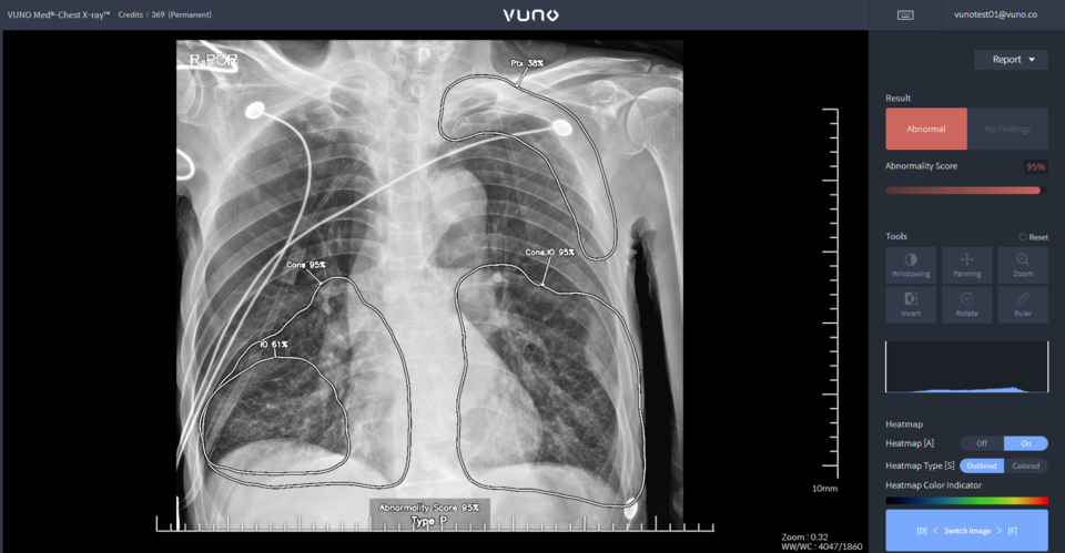 VUNO Med-Chest 카지노 룰렛 룰 예시 화면 /사진=뷰노