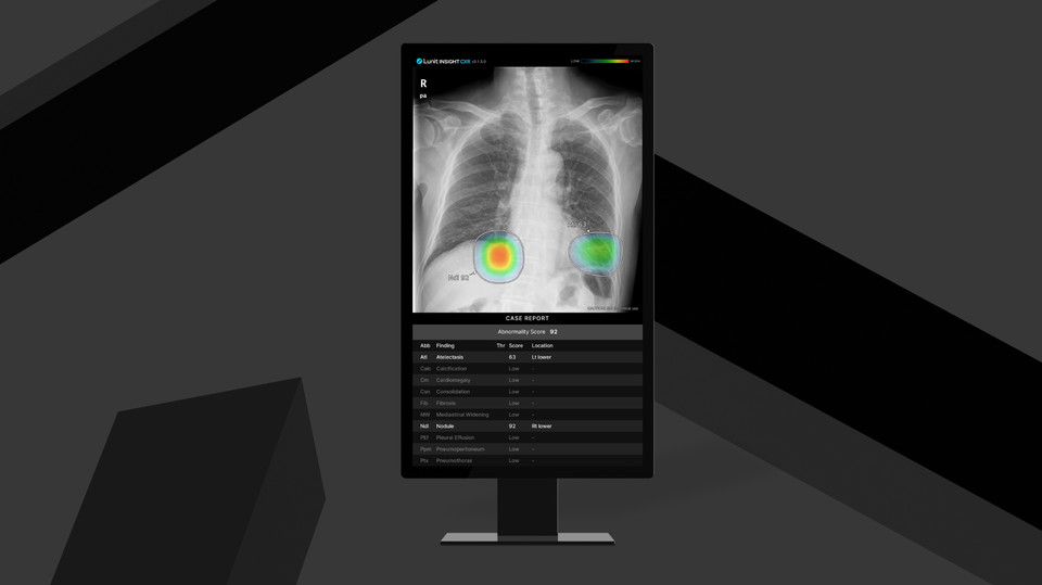 루닛 인사이트 CXR 예시화면 /사진=루닛