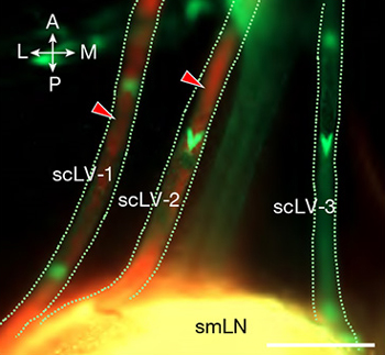 [이미지 1: 배수관. TMR-덱스트란 추적자는 하악하 림프절에서 모이는 표층 경부 림프관(scLV-1 및 -2)을 통해 흐른다.] [Jin et al., Nature, 2025에서 따옴]