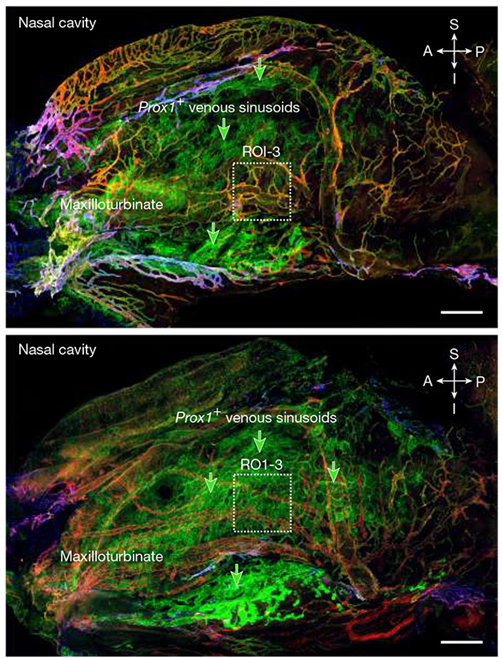 [이미지 2; 더 오래 살수록 혈관 수 감소. 림프관은 VEGFR3(빨간색)를 발현하며, 생후 2개월 된 생쥐(위)에서는 풍부하지만 생후 21개월 된 생쥐(아래)에서는 드물다. ROI-3 상자는 비강 림프관을 강조한다.] [Jin et al., Nature, 2025에서 따옴]