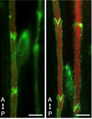 [이미지 4; 혈류 회복. 20~24개월 된 생쥐에서 TMR-덱스트란(빨간색)은 scLV-1 및 scLV-2 림프관을 통해 느리게 이동했다(왼쪽). 5분간의 기계적 자극으로 혈류가 회복되었다(오른쪽).] [Jin et al., Nature, 2025에서 따옴]