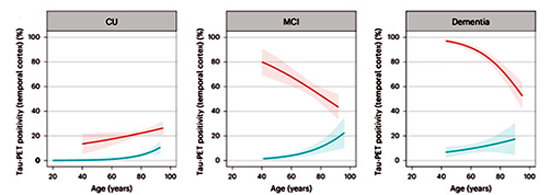 [그림 2. 탱글 경향. 아밀로이드 음성(파란색)인 사람들 중 탱글 유병률은 연령에 따라 증가했다. 인지 기능 장애가 없는 아밀로이드 양성(빨간색)인 사람들(왼쪽)의 경우에도 마찬가지였지만, 경도인지장애(MCI)(가운데)나 치매(오른쪽)가 있는 경우에는 탱글 유병률이 증가하지 않았다. [Ossenkoppele 외, Nature Neuroscience, 2025에서]