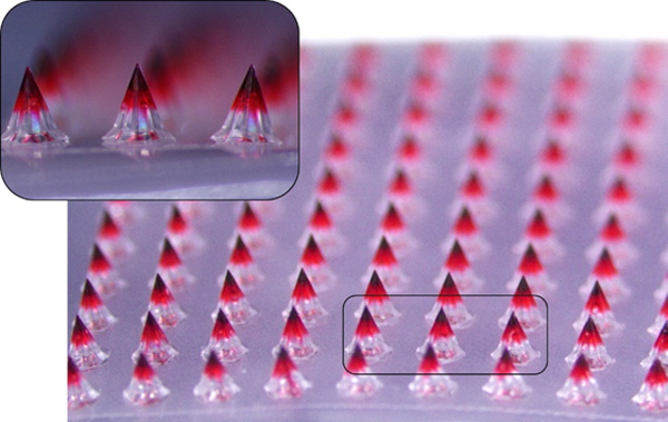 대웅테라퓨틱스가 개발한 마이크로니들 패치의 약물층을 시각적으로 표현하기 위해 색소를 첨가하고 6.7배 확대 촬영한 모습. 이미지=대웅제약.