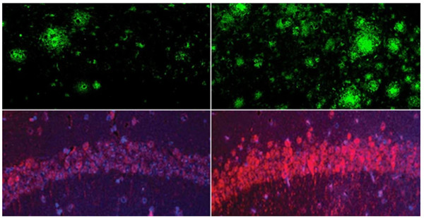 [그림 1: 뇌의 리튬 수치가 정상인 쥐(왼쪽)는 리튬 결핍이 있는 쥐(오른쪽)보다 아밀로이드 플라크(왼쪽 위)와 타우 엉킴(왼쪽 아래)이 적었다. 출처: Yankner Lab]