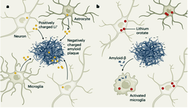 [그림 2] 알츠하이머병의 리튬 결핍. a, 알츠하이머병에서는 비정상적인 아밀로이드 β 펩타이드의 세포외 응집체가 뇌에 형성된다. Aron et al.은 이러한 음전하를 띤 아밀로이드 플라크가 리튬 양이온(Li+)을 격리하여 인접한 비플라크 조직에서 금속을 빼앗는다는 것을 발견했다. 이러한 뇌 세포의 리튬 결핍은 더 이상 정상적으로 기능할 수 없음을 의미하며, 이는 신경 퇴행과 인지 저하에 기여한다. b, 뇌의 리튬을 보충하기 위해 저자는 이온을 쉽게 형성하지 않아 아밀로이드 플라크에 의해 쉽게 격리되지 않는 리튬염인 lithium orotate를 식별했다. lithium orotate 치료는 미세아교세포(뇌의 면역 세포)가 amyloid-β를 제거하는 능력을 회복시켜 아밀로이드 플라크 축적이 악화되는 것을 막고, 알츠하이머병 마우스 모델에서 인지 기능 상실과 정상적인 노화를 예방하는 데 도움이 된다.