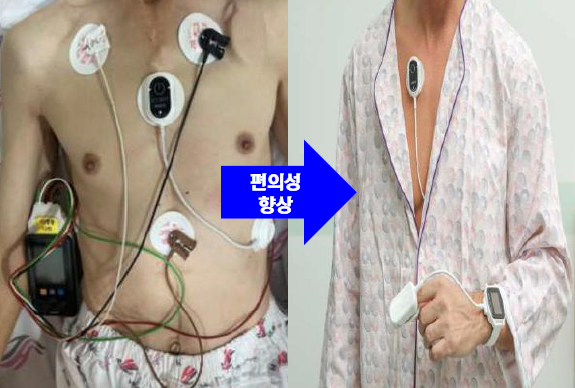 오른쪽은 씽크로 편의성을 개선한 모습. 사진=대웅제약 IR 보고서