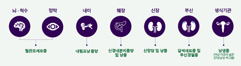 폰히펠-린다우 증후군 유발 종양 발생 부위