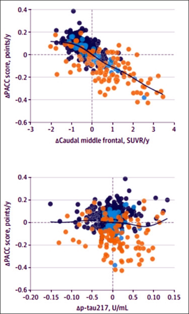 그림: 탱글은 인지를 추적한다. 아밀로이드 양성자(점)의 경우, 전두엽 영역의 타우 PET 신호가 증가함에 따라 PACC 점수가 악화된다(그림 위). 이와 대조적으로 혈장 p-Tau217의 변화(그림 아래)는 PACC 변화와 관련이 없다. 진한 파란색, 연한 파란색, 주황색 점은 각각 질병이 덜한 사람, 더 심한 사람, 가장 진행된 사람을 나타낸다. [Insel et al. 제공, JAMA Neurology, 2025.]