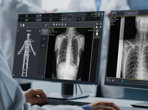 브이엑스뷰 활용 화면