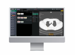 AVIEW 2.0 Summary 페이지 사진