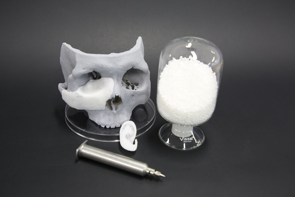 티앤알바이오팹의 환자맞춤형 임플란트