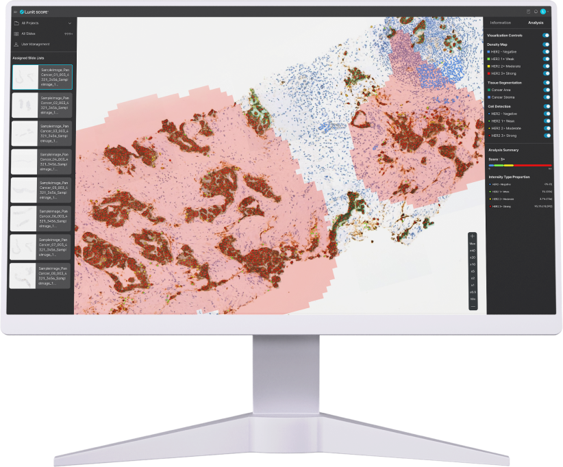 루닛 스코프 예시 화면