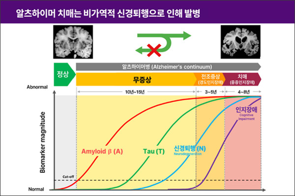 그림 1: 알츠하이머병을 점진적인 과정으로 그린 알츠하이머 연속체(Alzheimer's continuum).
