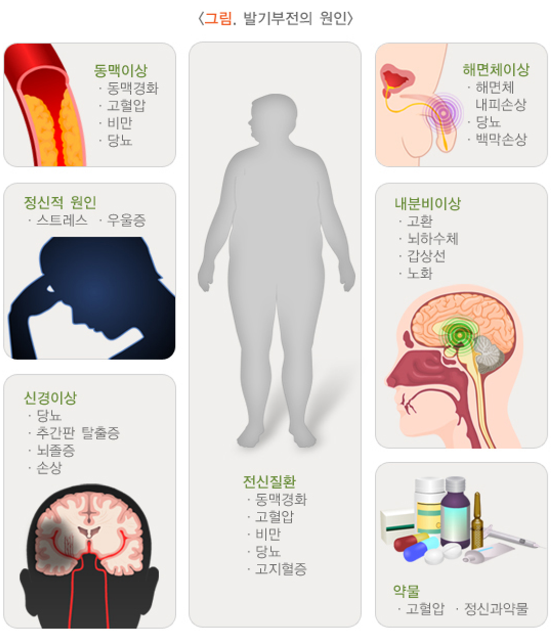 발기부전의 원인 / 출처=질병관리청 국가건강정보포털